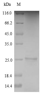 Greater than 90% as determined by SDS-PAGE.Recombinant Toxoplasma Gondii Dense Granule Protein 1 (GRA1) Protein (His)