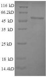 Greater than 90% as determined by SDS-PAGE.Recombinant Saccharomyces Cerevisiae Pyruvate Carboxylase 1 (PYC1) Protein (His)