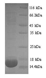 Greater than 90% as determined by SDS-PAGE.Recombinant Rat Phospholipase A2, Membrane Associated (PLA2G2A) Protein (His)