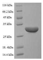 Greater than 90% as determined by SDS-PAGE.Recombinant Momordica Charantia Ribosome-Inactivating Protein Momordin I Protein (His)