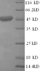 Greater than 90% as determined by SDS-PAGE.Recombinant Rotavirus A Intermediate Capsid Protein Vp6 Protein (His)