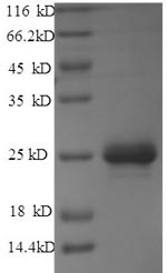 Greater than 90% as determined by SDS-PAGE.Recombinant Rabies Virus Matrix Protein (M) Protein (His)