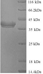 Greater than 90% as determined by SDS-PAGE.Recombinant Cryptomeria Japonica Pectate Lyase 1 Protein (His)