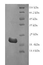 Greater than 90% as determined by SDS-PAGE.Recombinant Bovine Interferon Tau-1 (IFNT1) Protein (His)
