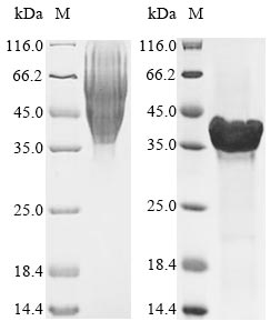 Greater than 85% as determined by SDS-PAGE.Recombinant Aggregatibacter Actinomycetemcomitans Leukotoxin (LTXA) Protein (His)