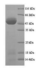 Greater than 90% as determined by SDS-PAGE.Recombinant African Cassava Mosaic Virus Replication-Associated Protein (AC1) Protein (His)