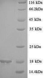 Greater than 90% as determined by SDS-PAGE.Recombinant Glycine Max 2S Seed Storage Albumin Protein Protein (His)
