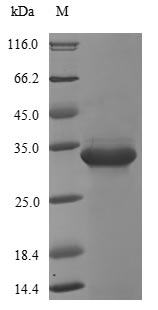 Greater than 90% as determined by SDS-PAGE.Recombinant E.Coli Transcriptional Regulatory Protein Phop (PHOP) Protein (His&Myc)