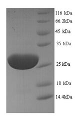 Greater than 90% as determined by SDS-PAGE.Recombinant Trichosanthes Kirilowii Ribosome-Inactivating Protein Karasurin-C Protein (His)