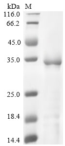 Greater than 90% as determined by SDS-PAGE.Recombinant Enterobacteria Phage Prd1 Spike Protein P5 (V) Protein (His)