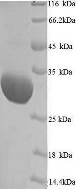 Greater than 90% as determined by SDS-PAGE.Recombinant Human Rhinovirus 1A Genome Polyprotein Protein (His)