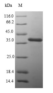 Greater than 90% as determined by SDS-PAGE.