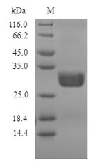 Greater than 90% as determined by SDS-PAGE.Recombinant Penicillium Citrinum Nuclease P1 Protein (His)