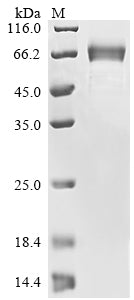 Greater than 85% as determined by SDS-PAGE.Recombinant Human Sars-Cov-2 Spike Glycoprotein (S) Protein (His-PDI)