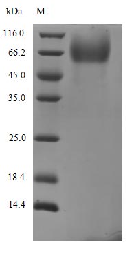 Greater than 90% as determined by SDS-PAGE.Recombinant Sars-Cov-2 Spike Glycoprotein (S) Protein (His-PDI)