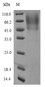 Greater than 90% as determined by SDS-PAGE.Recombinant Human Sars-Cov-2 Spike Glycoprotein (S) Protein (His-sumostar)