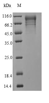 Greater than 85% as determined by SDS-PAGE.