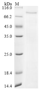 Greater than 90% as determined by SDS-PAGE.Recombinant Human Sars-Cov-2 Nucleoprotein (N) Protein (His-PDI)