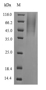 Greater than 90% as determined by SDS-PAGE.