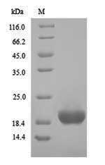 Greater than 90% as determined by SDS-PAGE.Recombinant Clostridium Botulinum Hemagglutinin Component Of The Neurotoxin Complex (HA17) Protein (His)