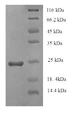 Greater than 90% as determined by SDS-PAGE.Recombinant Bovine Coronavirus Spike Glycoprotein (S) Protein (His)