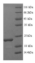 Greater than 90% as determined by SDS-PAGE.Recombinant Glycine Max Stress-Induced Protein Sam22 (PR-10) Protein (His)