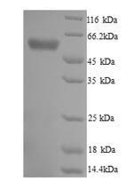 Greater than 90% as determined by SDS-PAGE.Recombinant Trypanosoma Cruzi Trypanothione Reductase (TPR) Protein (His)