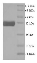 Greater than 90% as determined by SDS-PAGE.Recombinant Caenorhabditis elegans ATP-dependent (R107.2) Protein (His)