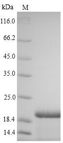 Greater than 90% as determined by SDS-PAGE.Recombinant Hepatitis B Virus Genotype C Subtype Adr Large Envelope Protein (S) Protein (His)