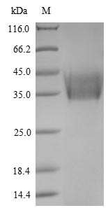 Greater than 85% as determined by SDS-PAGE.Recombinant Newcastle Disease Virus Hemagglutinin-Neuraminidase (HN) Protein (His&Myc)