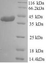 Greater than 90% as determined by SDS-PAGE.Recombinant Human Coronavirus Oc43 Spike Glycoprotein (S) Protein (His)
