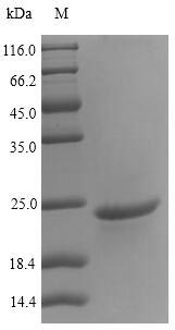 Greater than 90% as determined by SDS-PAGE.Recombinant Carpinus Betulus Major Pollen Allergen Car B 1 Isoform 2 Protein (His)