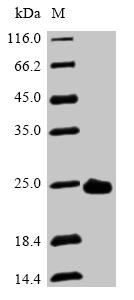 Greater than 90% as determined by SDS-PAGE.Recombinant Human Peroxiredoxin-2 (PRDX2) Protein (His)