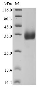 Greater than 90% as determined by SDS-PAGE.Recombinant Bovine Coronavirus Spike Glycoprotein (S) Protein (His)