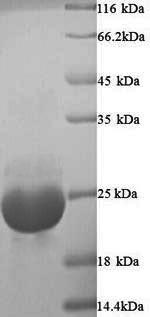 Greater than 90% as determined by SDS-PAGE.Recombinant Onchocerca Volvulus Ov-16 Antigen (OV16) Protein (His)