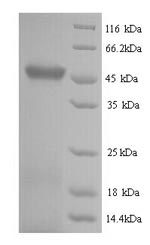 Greater than 90% as determined by SDS-PAGE.Recombinant E.Coli Rna-Splicing Ligase Rtcb (RTCB) Protein (His)