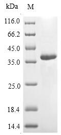 Greater than 90% as determined by SDS-PAGE.Recombinant Vespula Vulgaris Phospholipase A1 (PLA1) Protein (Myc&His)