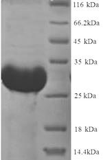 Greater than 90% as determined by SDS-PAGE.Recombinant Rat Thyroxine 5-Deiodinase (DIO3) Protein (His)