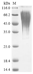 Greater than 90% as determined by SDS-PAGE.Recombinant Human Putative Teratocarcinoma-Derived Growth Factor 3 (TDGF1P3) Protein (His)