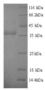 Greater than 90% as determined by SDS-PAGE.Recombinant Helicobacter Pylori Cytotoxicity-Associated Immunodominant Antigen (CAGA) Protein (His)