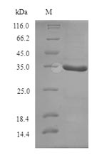 Greater than 90% as determined by SDS-PAGE.Recombinant Geobacillus Stearothermophilus Atp-Dependent Dna Helicase Pcra (PCRA) Protein (His)