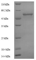 Greater than 90% as determined by SDS-PAGE.Recombinant Mycobacterium Tuberculosis Steroid C26-Monooxygenase (CYP125) Protein (His)