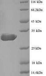 Greater than 90% as determined by SDS-PAGE.