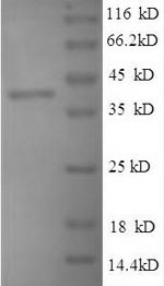 Greater than 85% as determined by SDS-PAGE.Recombinant Mycobacterium Tuberculosis Peptidoglycan-Binding Protein Arfa (ARFA) Protein (His/Tag-Free)