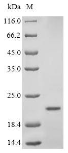 Greater than 90% as determined by SDS-PAGE.Recombinant Mouse Insulin-1 (INS1) Protein (His&Myc)