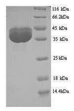 Greater than 90% as determined by SDS-PAGE.Recombinant Jc Polyomavirus Minor Capsid Protein Vp2 Protein (His)