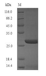 Greater than 90% as determined by SDS-PAGE.Recombinant Influenza A Virus Hemagglutinin (HA) Protein (His)