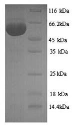 Greater than 90% as determined by SDS-PAGE.Recombinant Influenza A Virus Nucleoprotein (NP) Protein (His)