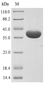 Greater than 85% as determined by SDS-PAGE.Recombinant Influenza A Virus Hemagglutinin (HA) Protein (His)