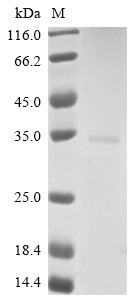 Greater than 90% as determined by SDS-PAGE.Recombinant Vesicular Stomatitis Indiana Virus Matrix Protein (M) Protein (His)